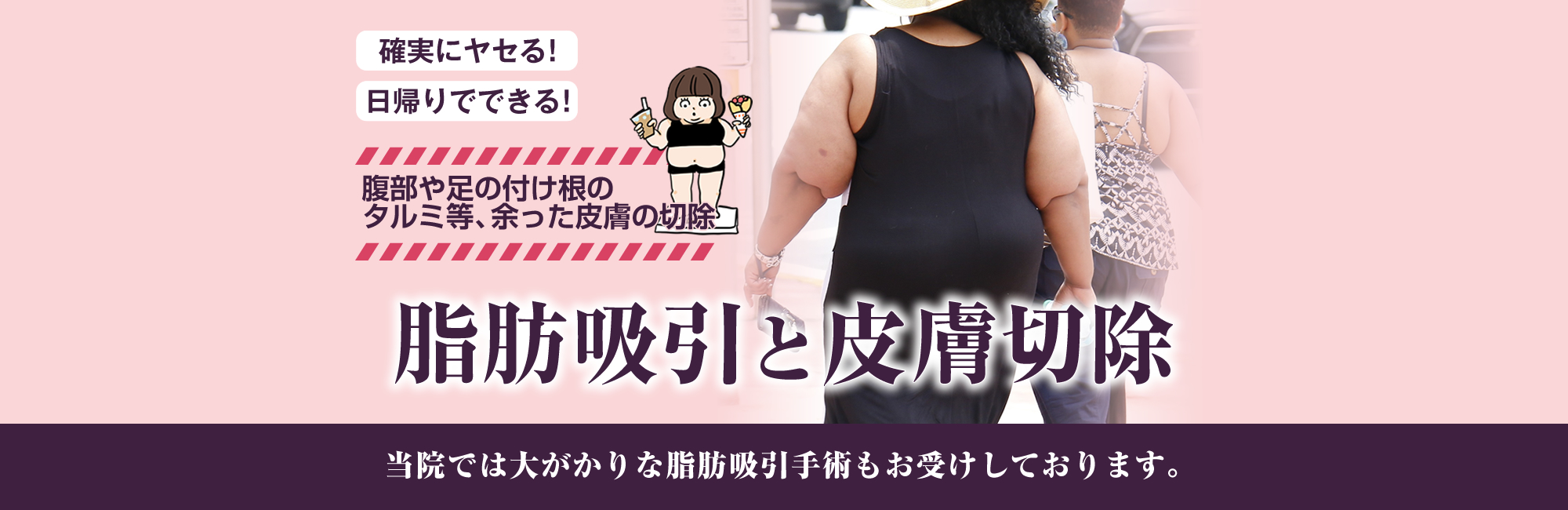 確実にヤセる!日帰りでできる!腹部や足の付け根のタルミ等、余った皮膚の切除。脂肪吸引と皮膚切除。当院では大がかりな脂肪吸引もお受けしております。