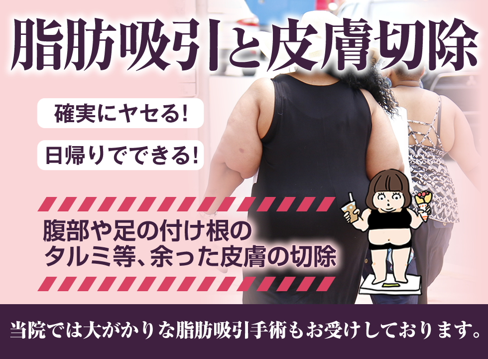 確実にヤセる!日帰りでできる!腹部や足の付け根のタルミ等、余った皮膚の切除。脂肪吸引と皮膚切除。当院では大がかりな脂肪吸引もお受けしております。