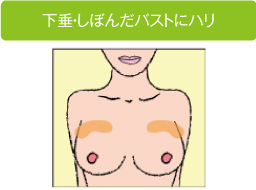 下垂・しぼんだバストにハリ