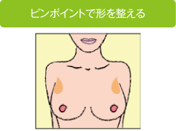 ピンポイントで形を整える