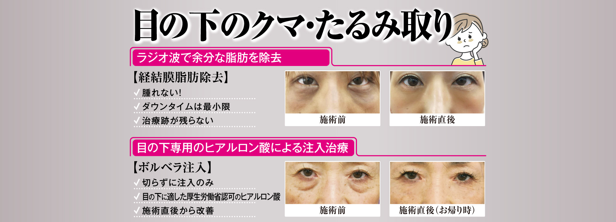 目の下のクマ・たるみ取り[目の下のクマ・たるみ取り][目の下のクマ・たるみ取り]